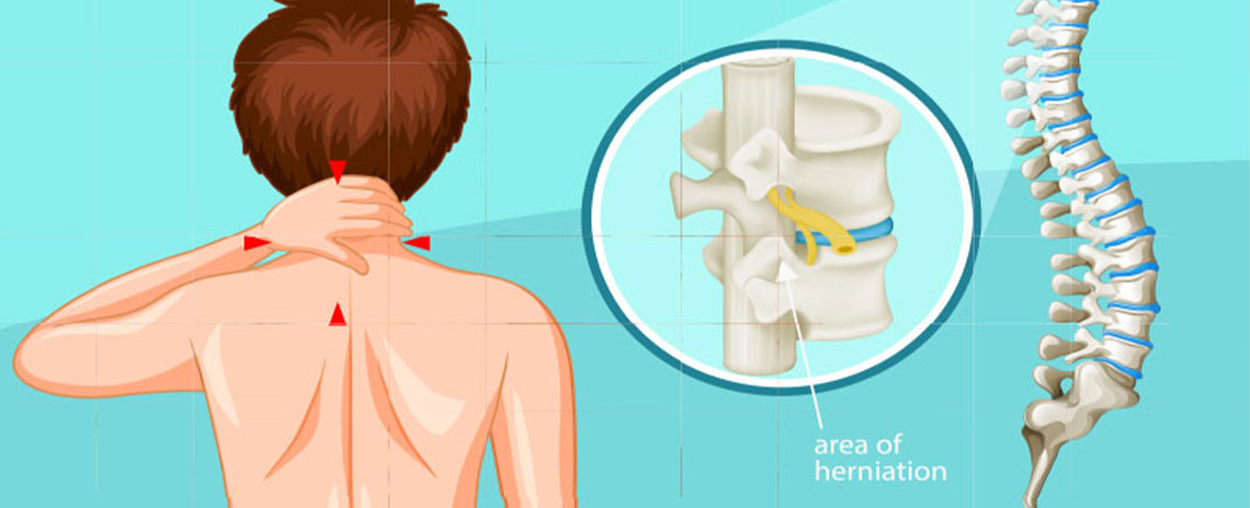 https://www.sanrafaelchiropractor.com/images/chiropractic-blog/pinched-nerve-pain.jpg