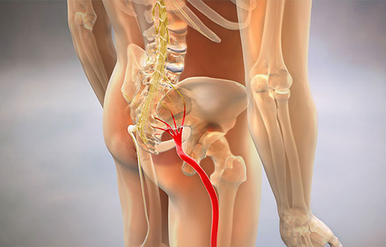 Diagram of sciatic nerve