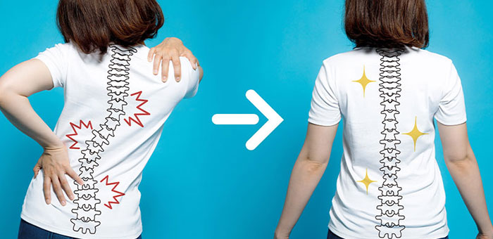 patient with good posture after chiropractic treatment from San Rafael chiropractor