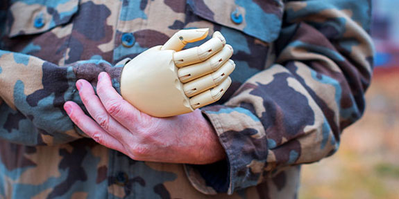 phantom limb syndrome Treatment in San Rafael