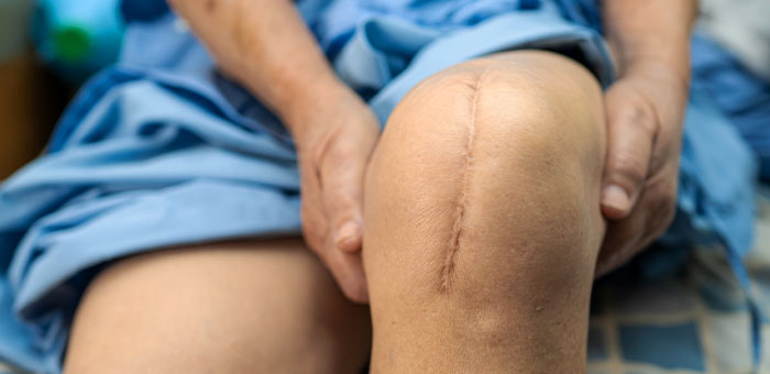 patient needing post surgical neuropathic pain treatment in San Rafael