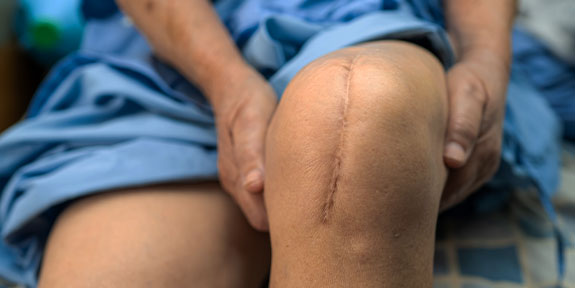 post surgical neuropathic pain Treatment in San Rafael