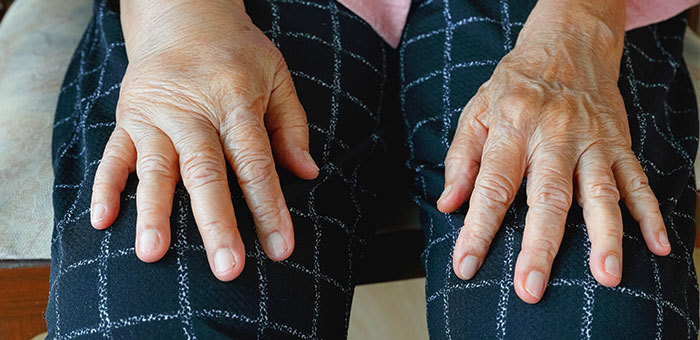 patient needing reflex sympathetic dystrophy treatment in San Rafael