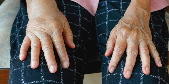 reflex sympathetic dystrophy Treatment in San Rafael