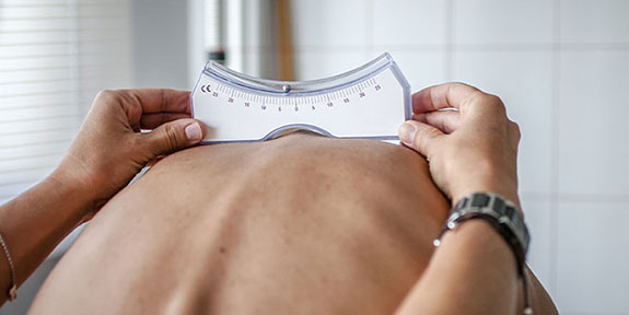 scoliosis Treatment in San Rafael